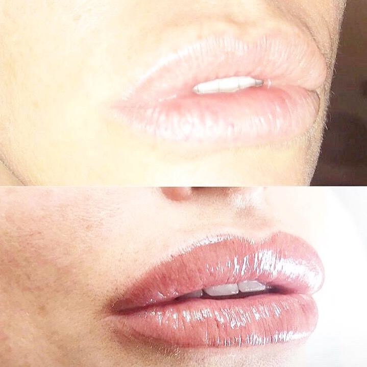 Luxurious Lips